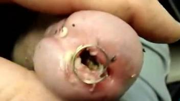 Dude's urethra is now filled with lots of maggots